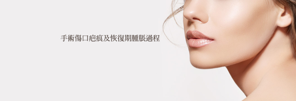 墊法令紋貴族手術