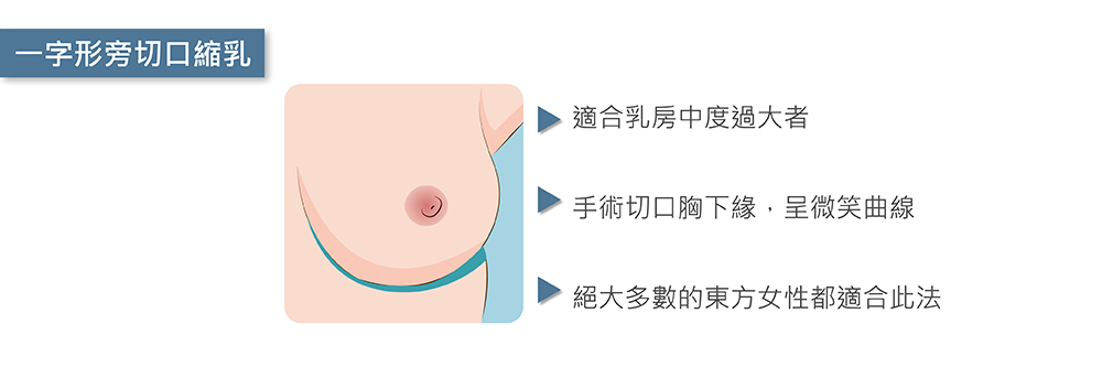 一字型平胸手術