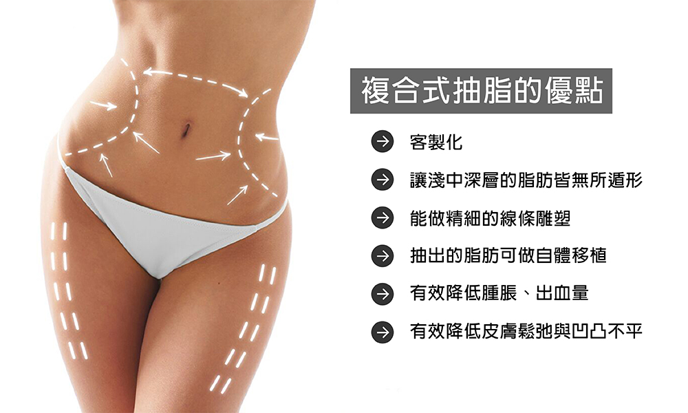 台中複合式抽脂03