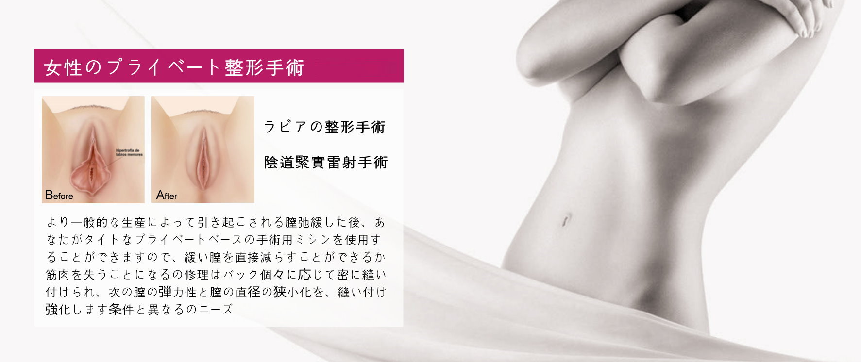 私密處手術台中女醫師,陰道整形緊實,縮陰道,G點注射