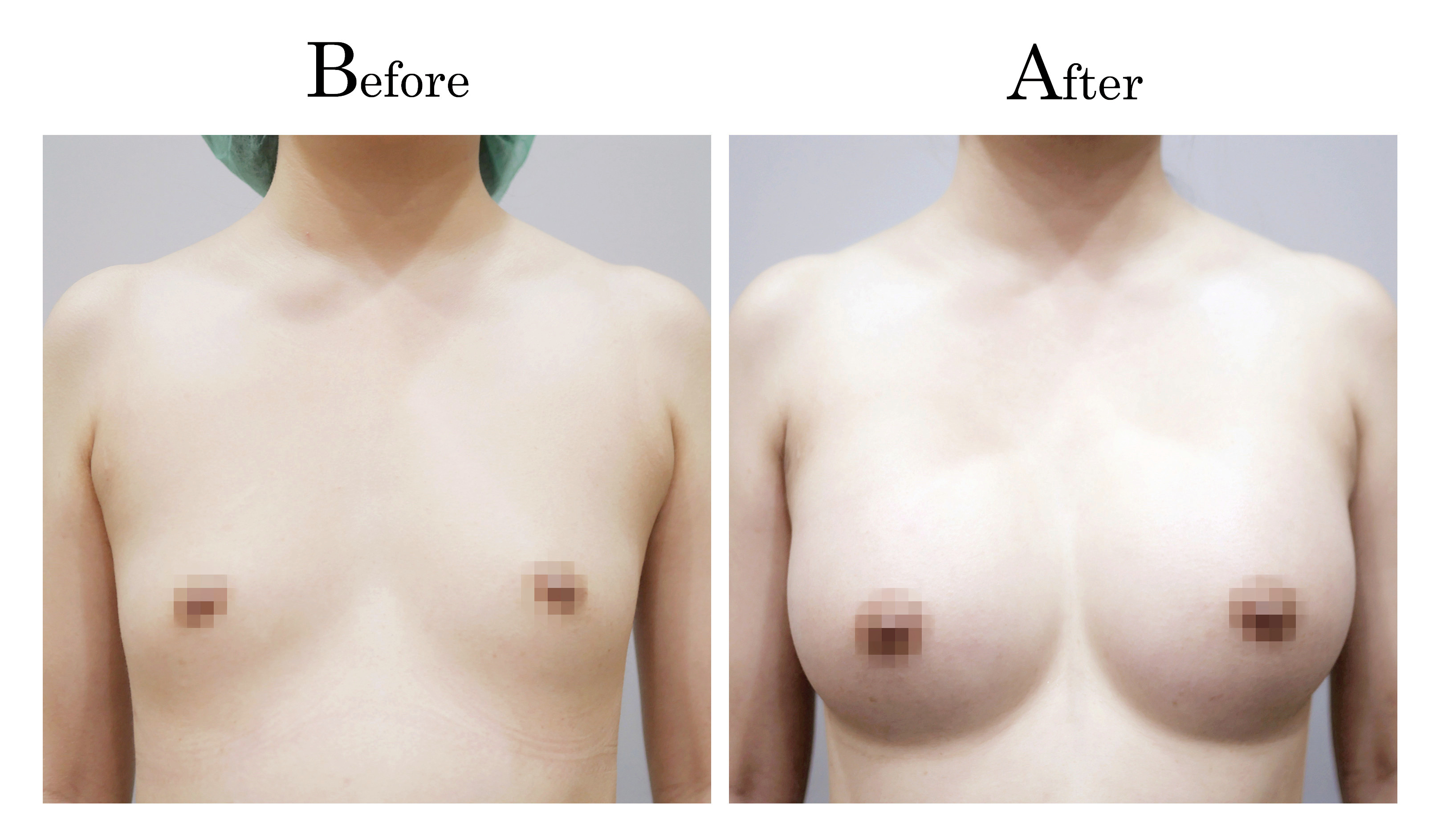 台中魔滴保固,魔滴失敗