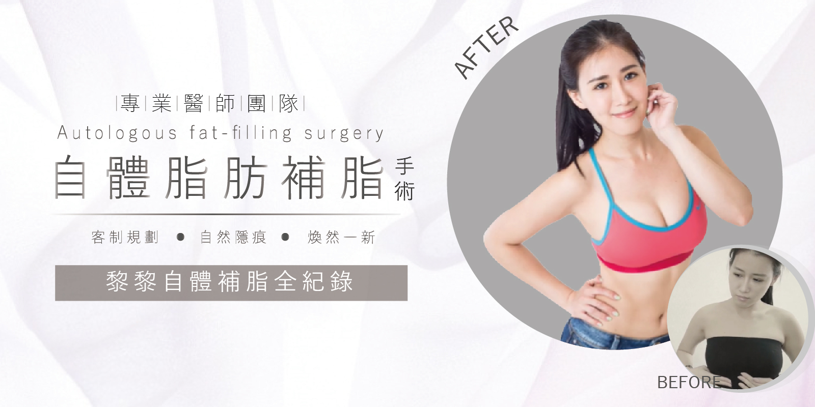 自體脂肪補臉手術案例