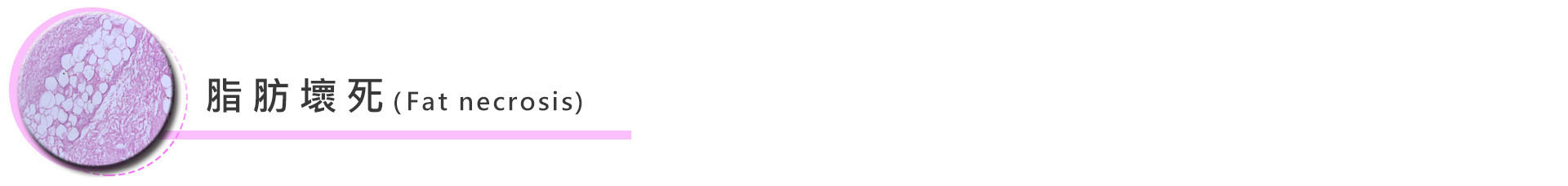 脂肪壞死:脂肪過量注射或過度集中,會造成血液供氧不足,脂肪無法存活而壞死。大部分壞死的脂肪細胞會被身體吸收,萬一壞死脂肪量過大,未被吸收,會造成囊腫、鈣化,甚至是被注射部位的變形,此時就須要靠二次手術將其取出。