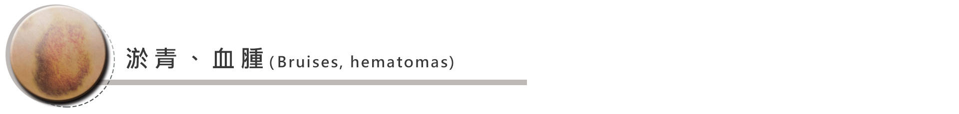 脂肪供區之併發症諸如淤青、血腫:術後的瘀青或腫漲不論是抽取脂肪的部位或是填補的部位往往會很明顯,通常瘀青恢復需要數周的時間,而腫漲消除的話有時則需要數月的時間。