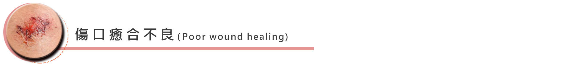 術後感染、傷口癒合不良:因為抽脂本身算是的個很大的創傷,有時對於傷口不容易癒合或是免疫力相對較低的病患,就容易發生併發症的情形。