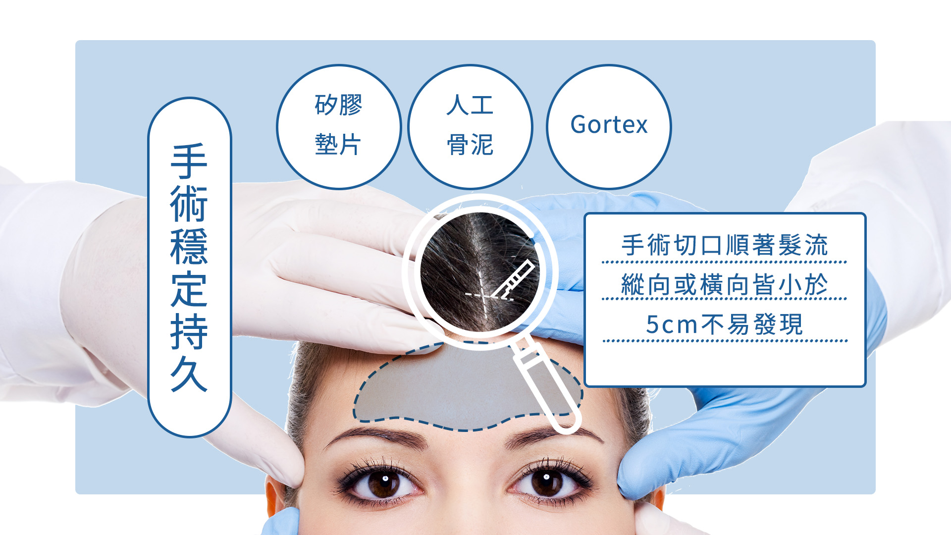 傳統額頭墊片豐額