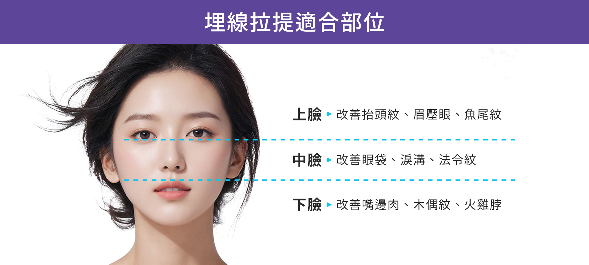 台中臉部埋線拉提拉皮002