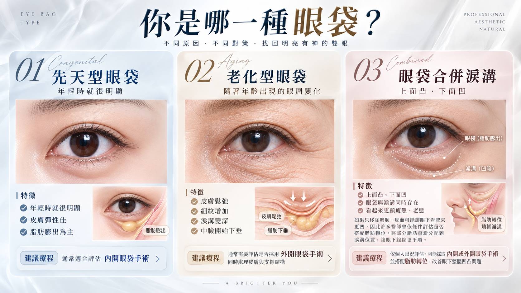 你是哪一種眼袋? - 台中教主醫美