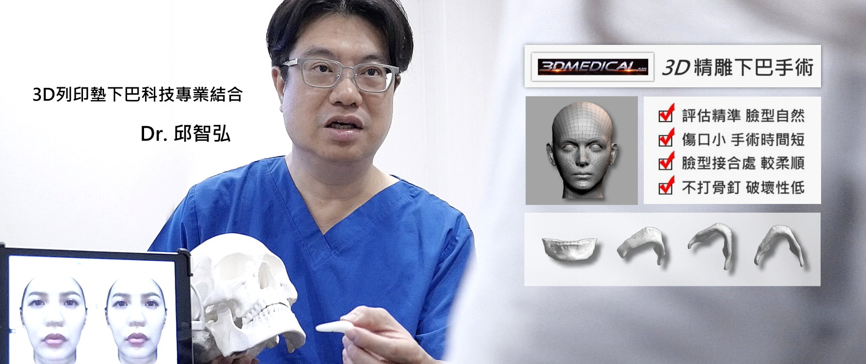 墊下巴權威邱智弘醫師,台中大雄老師