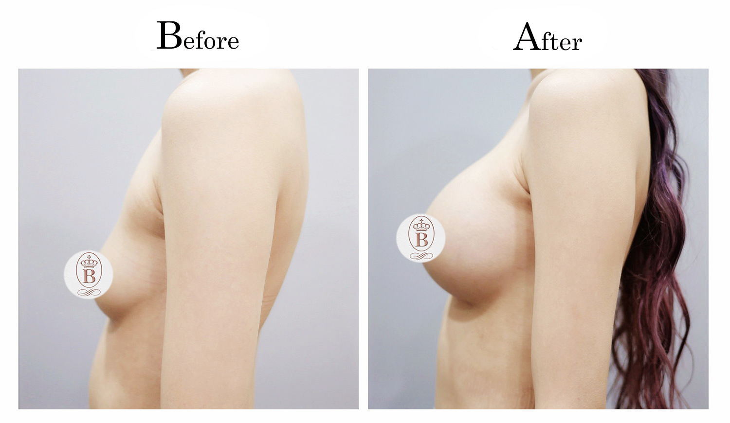 台中魔低價位,台中魔滴費用