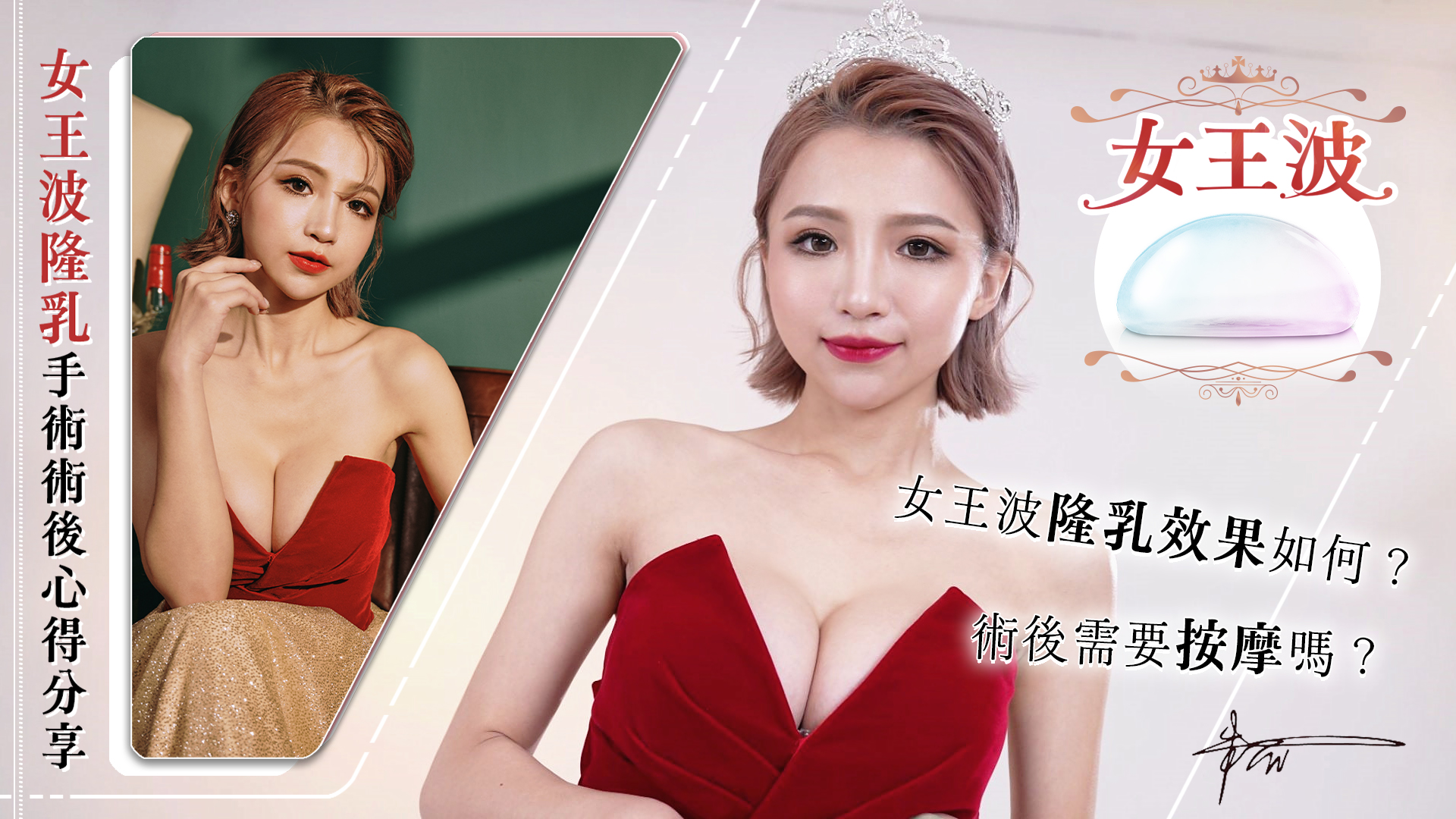 台中隆乳手術權威邱智弘醫師推薦女王波朱兒